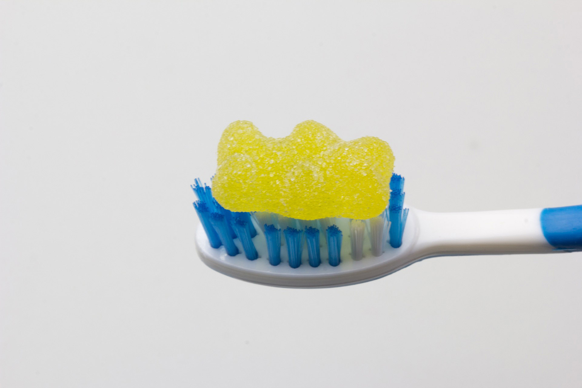 Caries: La enfermedad más común