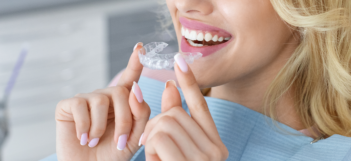 Preguntas frecuentes sobre el sistema Invisalign